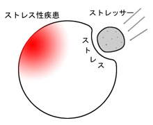 ストレス図